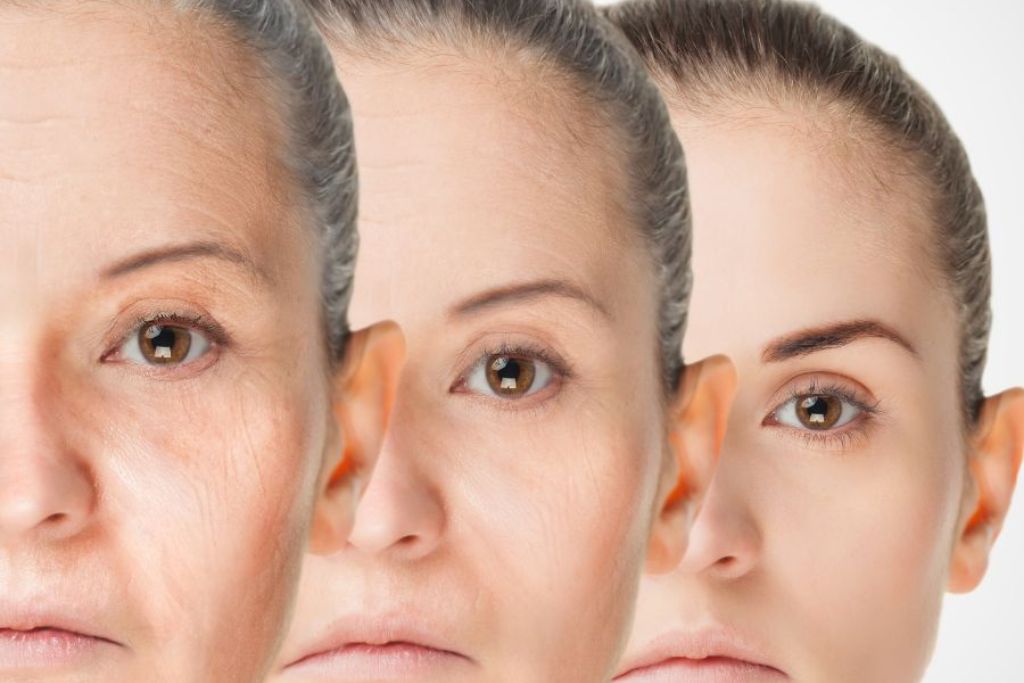 Woman undergoing Anti-Ageing Drip Treatment at Glam Aesthetics beauty clinic, Hyderabad