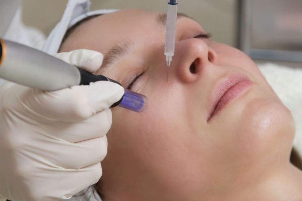 Derma pen treatment at Glam Aesthetics, Hyderabad.