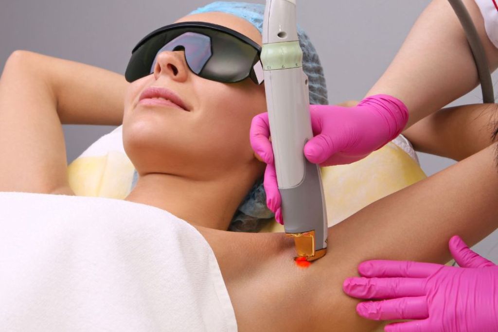 Laser hair reduction treatment at Glam Aesthetics, Hyderabad.
