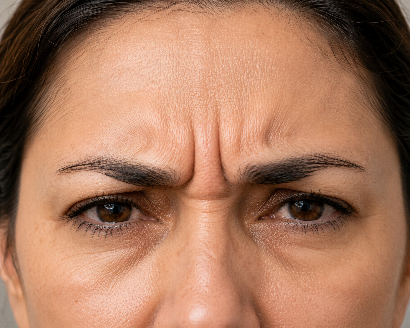 Frown lines treatment