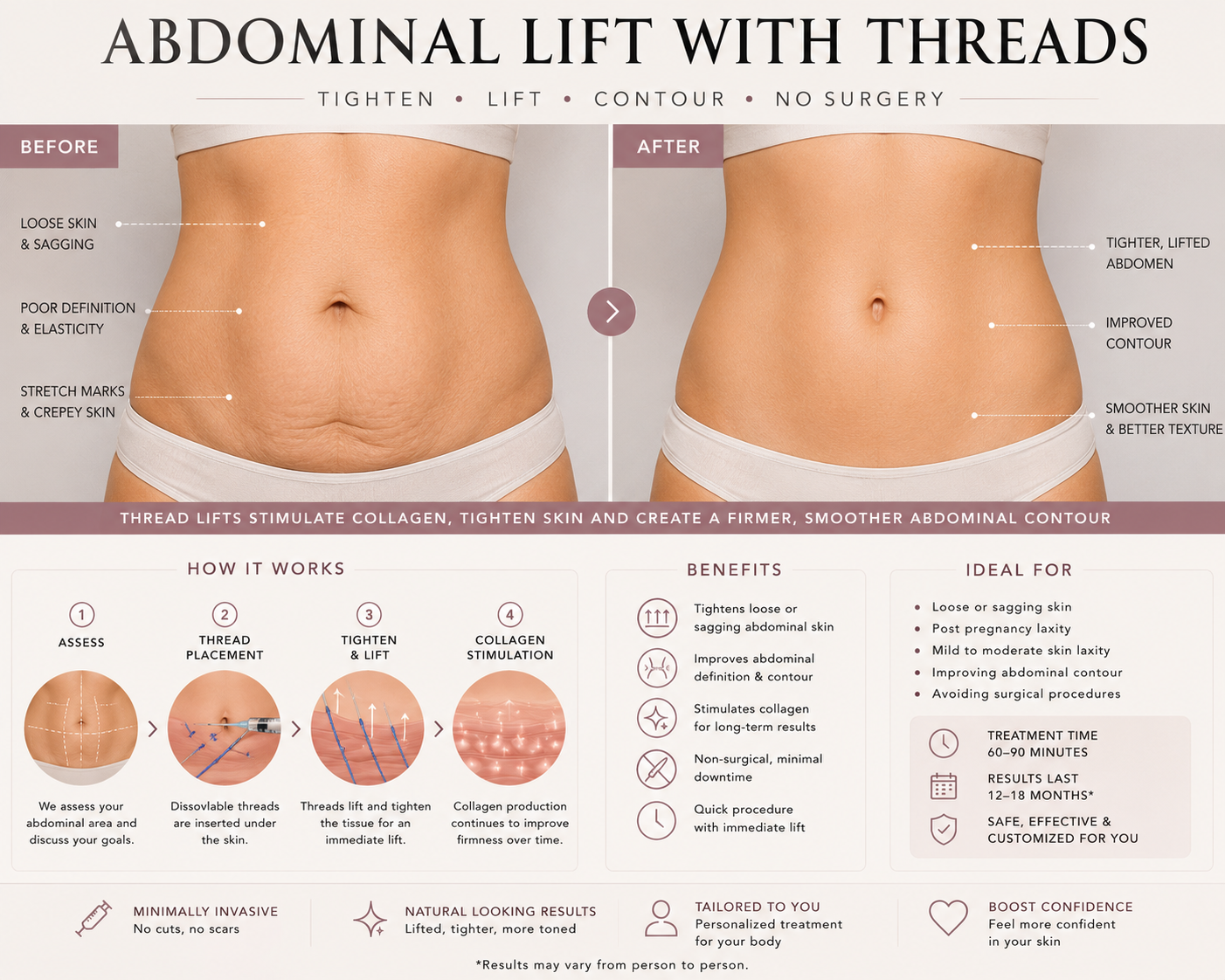 Abdomen contour